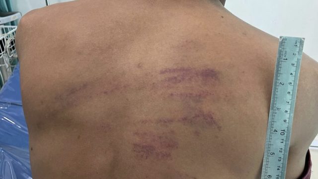 Diduga Aniaya Warga Pakai Selang, Oknum Danpos AL Pulau Ngenang Dilaporkan ke POMAL